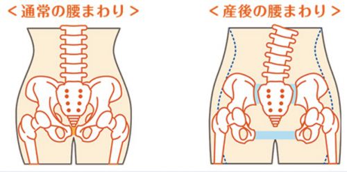 産後の骨盤の歪み問題、ここまで歪んだら普通死んじゃうよ〜！！