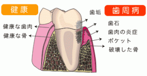 腸と歯の繋がりが健康をつくる？！