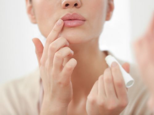 唇には意外とシミができやすい！原因・予防とシミを消す方法